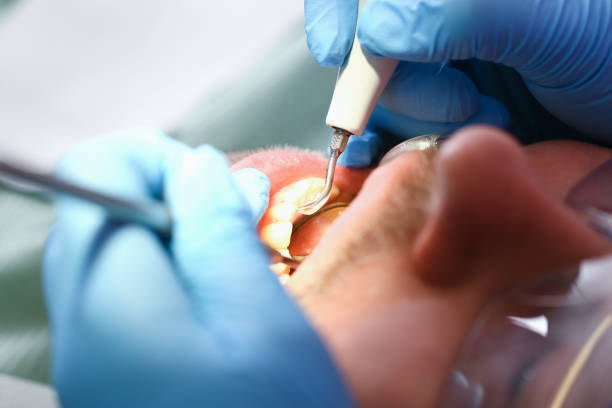 Best Knocked-Out Tooth Emergency  in Morrow, OH